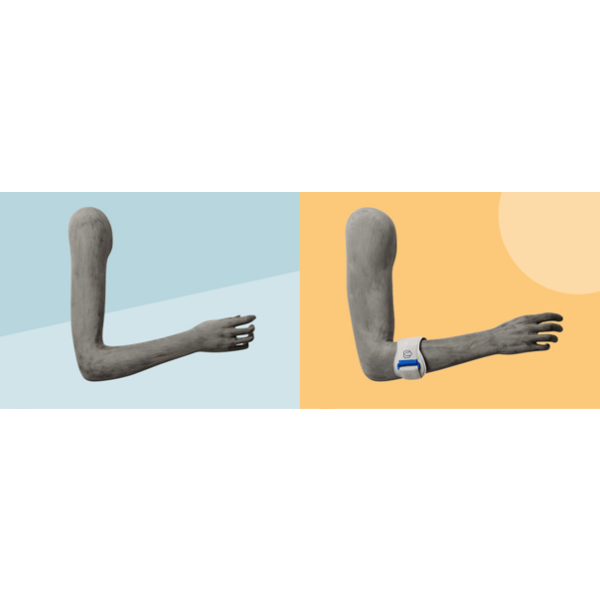 ORTHOPEDIC Arm-Display Dame OTWFAO1R